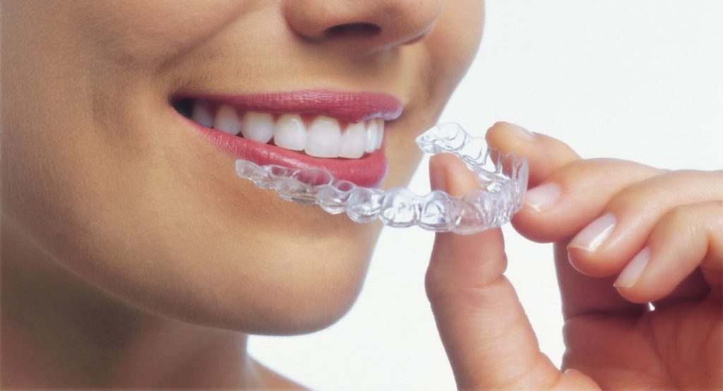 Clear aligners